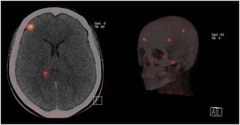 Widok podczas badnia mózgu i czaszki. Medycyna nuklearna