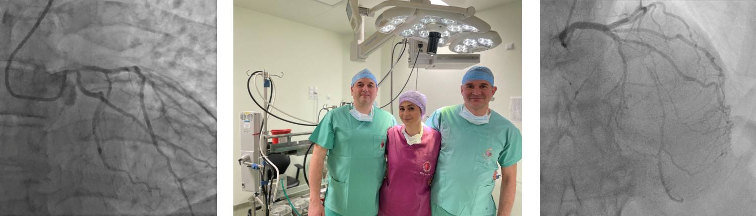 Zespół wykonujący małoinwazyjną wielonaczyniową operację pomostowania aortalno-wieńcowego (MICS CABG) i obrazy z badania koronarograficznego
