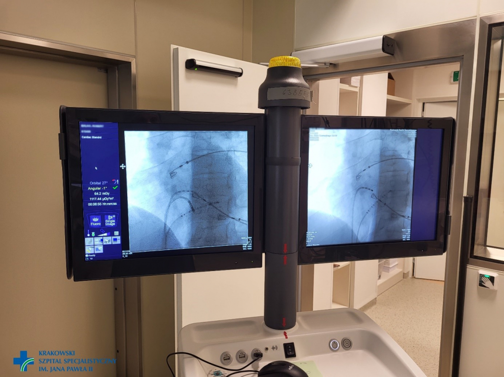 Zdjęcia radiologiczne na ekranie