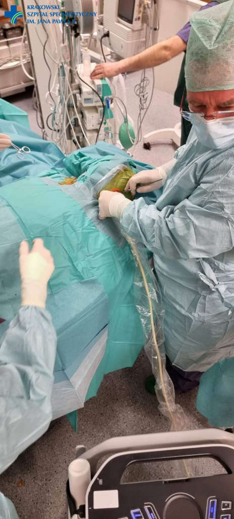 Zabieg implantacji protezy aorty 