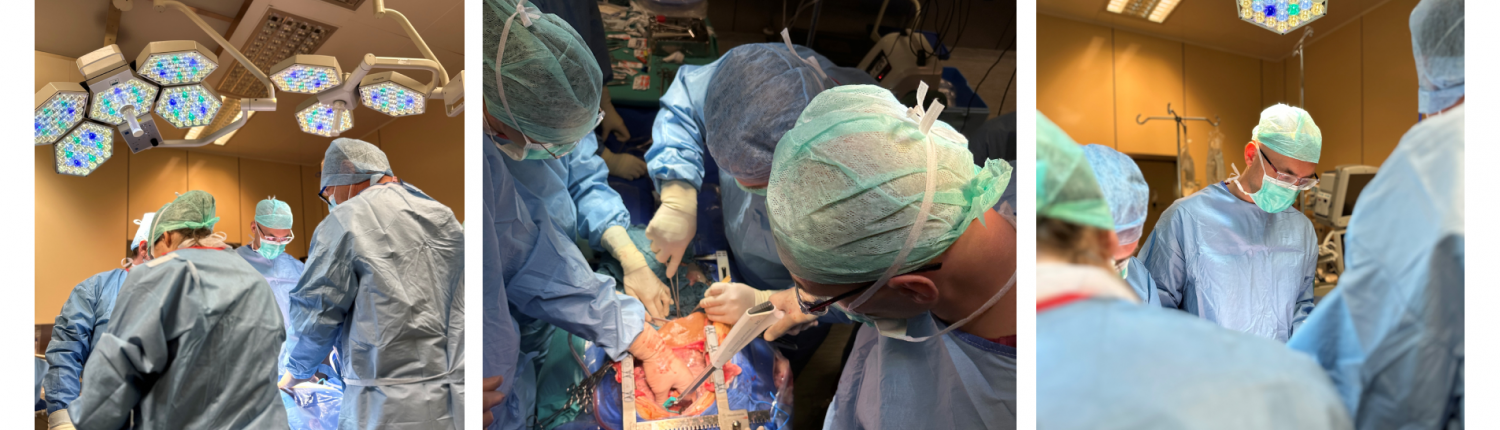 Zespół operacyjny podczas przeszczepienia płuc